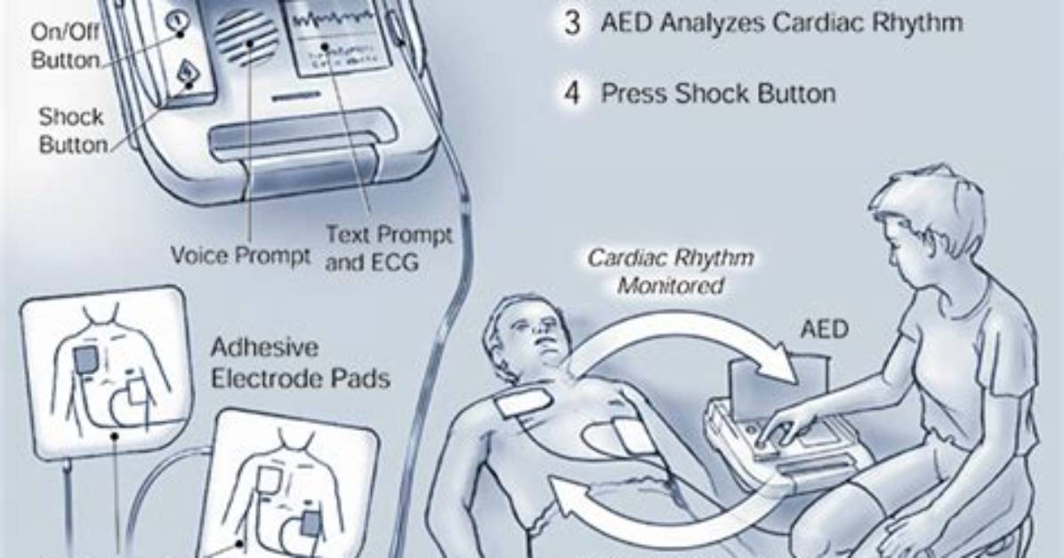 What Does Defibrillation Do?