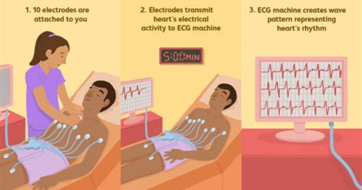 What Does Electrocardiography Test for?