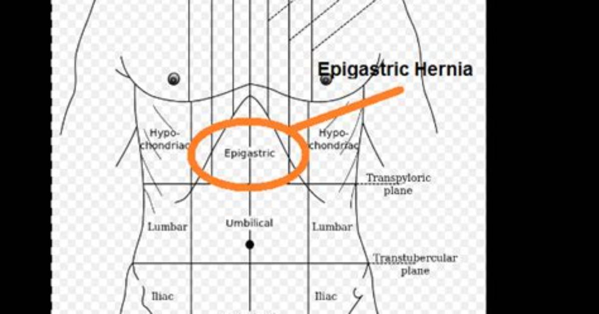 What Does Epigastric Mean