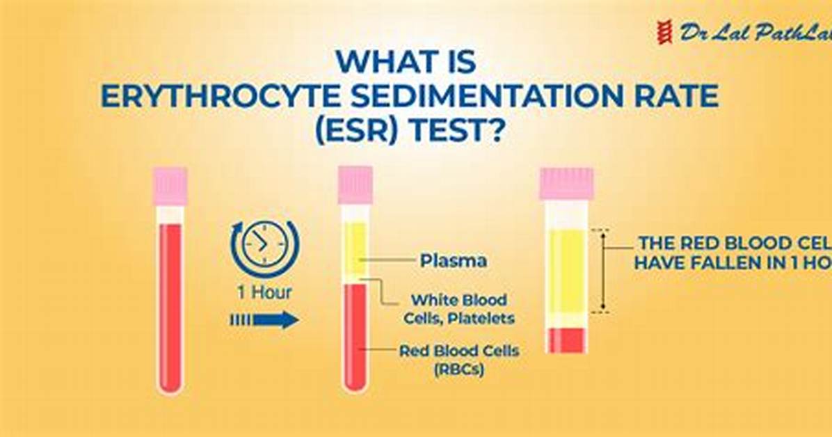 What Does Esr Stand For