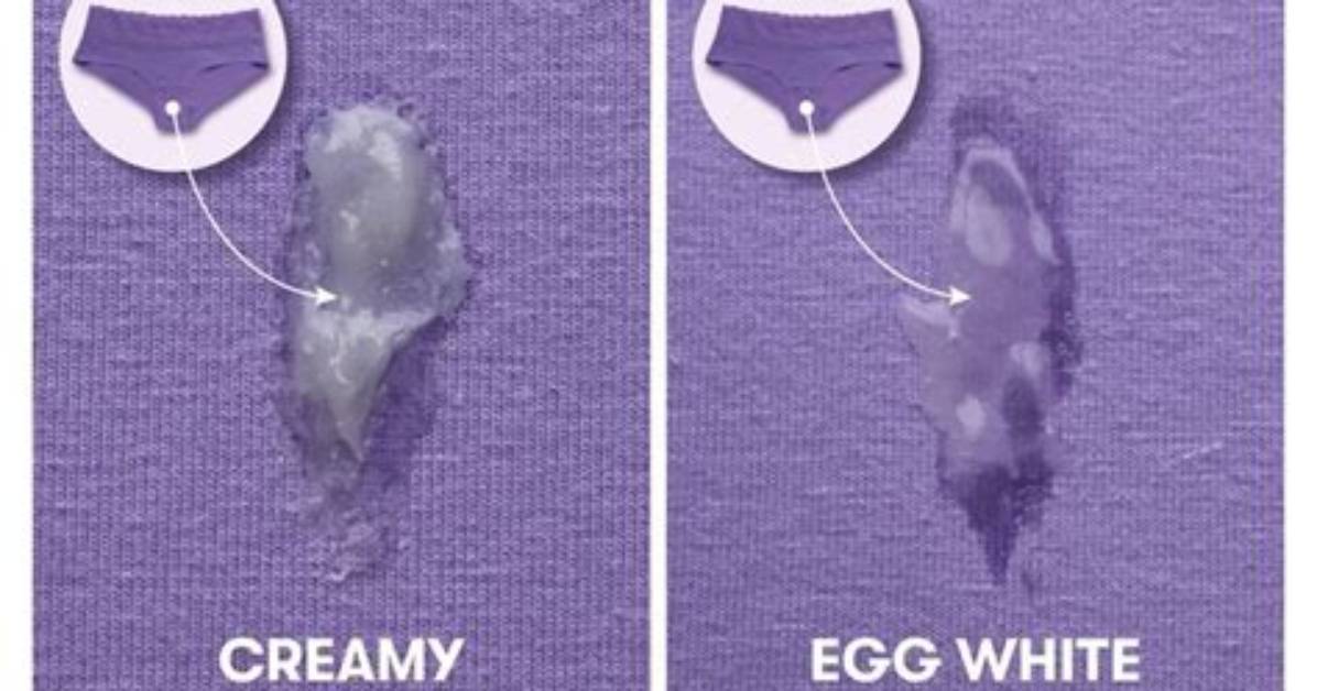 What Does Excess Discharge Mean?