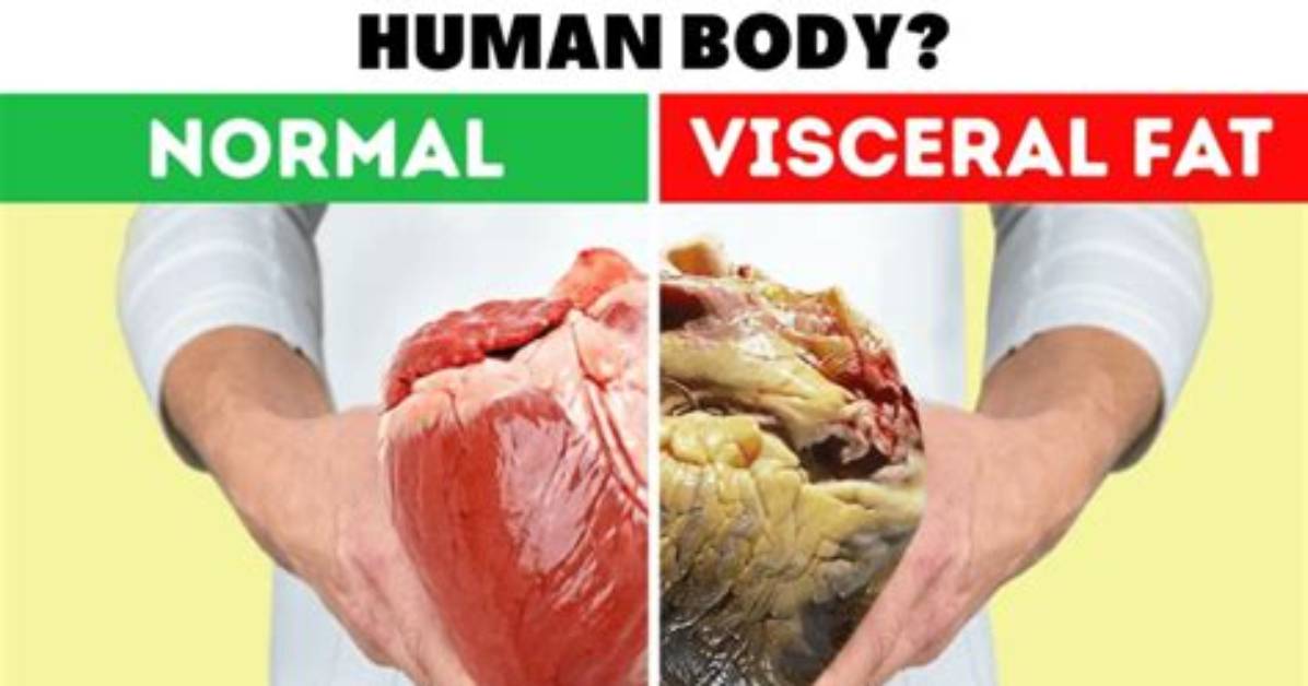 What Does Fat Do to the Heart