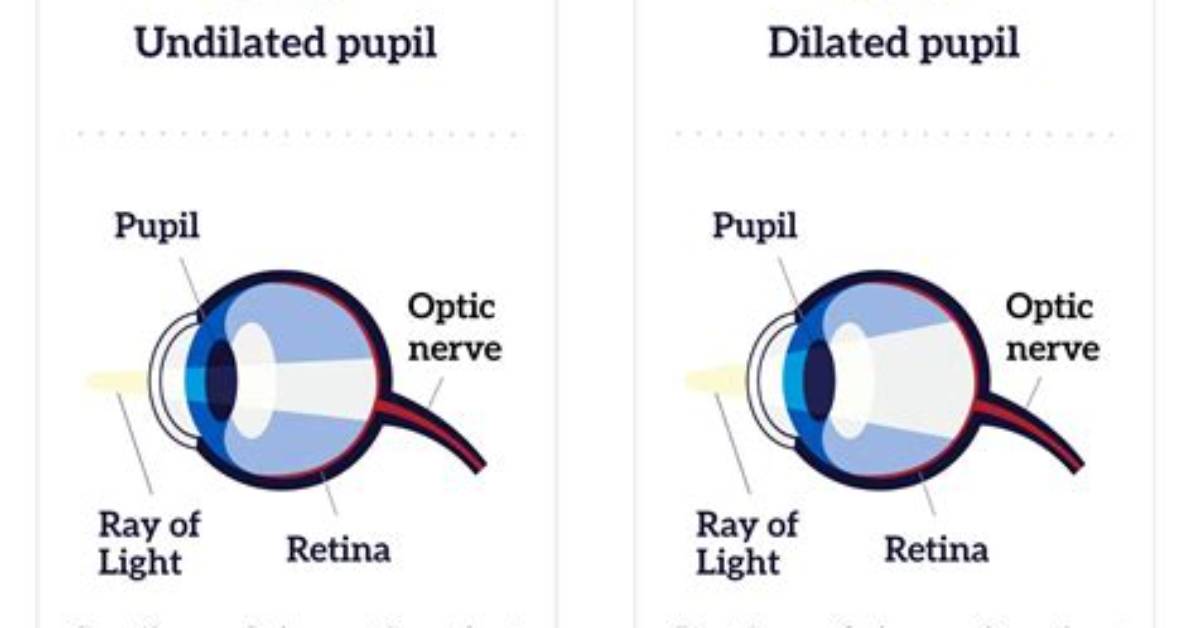 What Does Fully Dilated Mean?