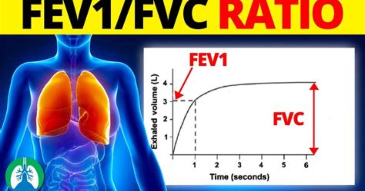 What Does Fvc Stand for in Medical Terms