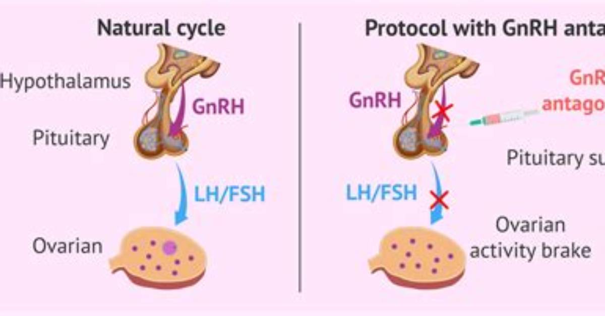 What Does Gnrh Stand For