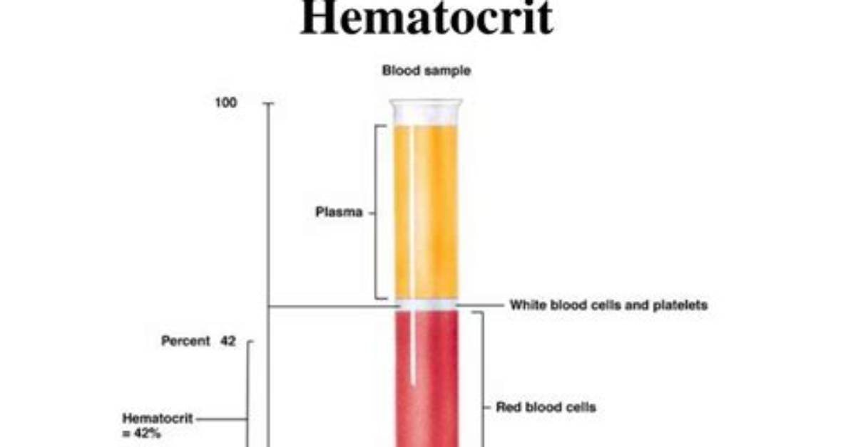 What Does Hematocrit Mean?