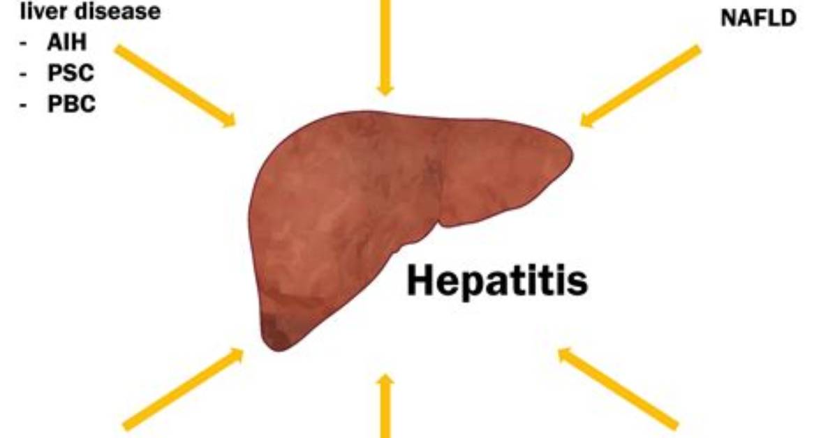 What Does Hepatoptosis Mean?