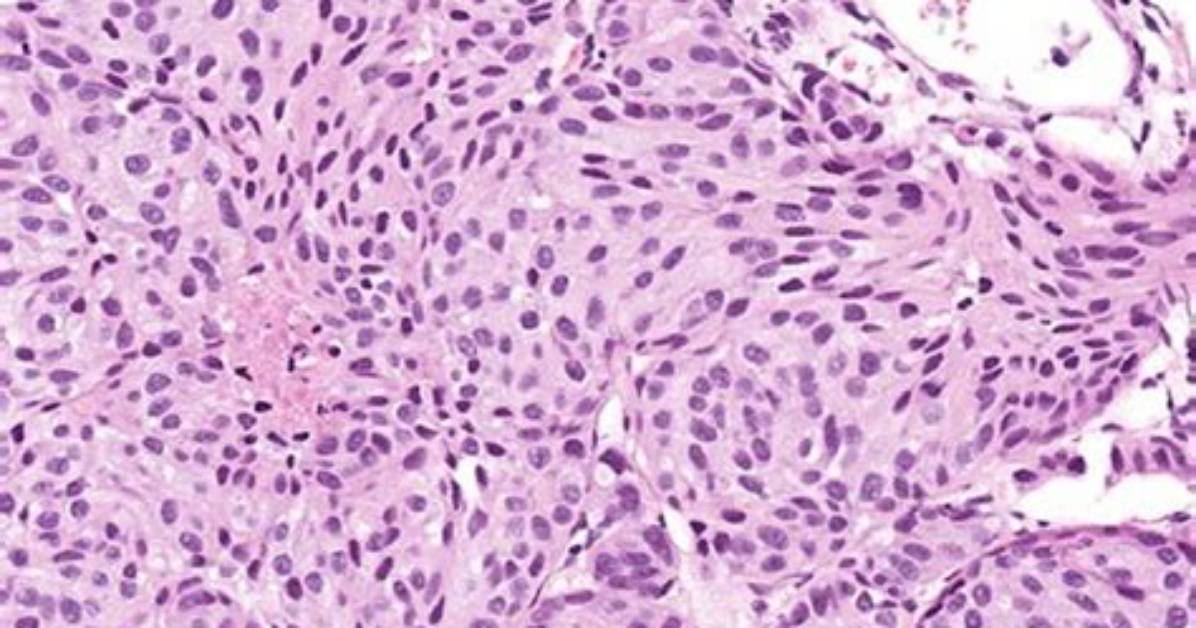 What Does Histologic Mean