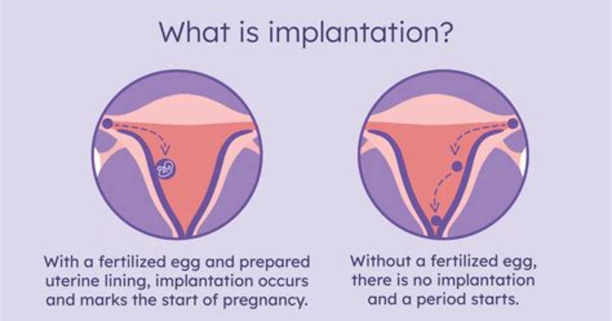 What Does Implantation Feel Like