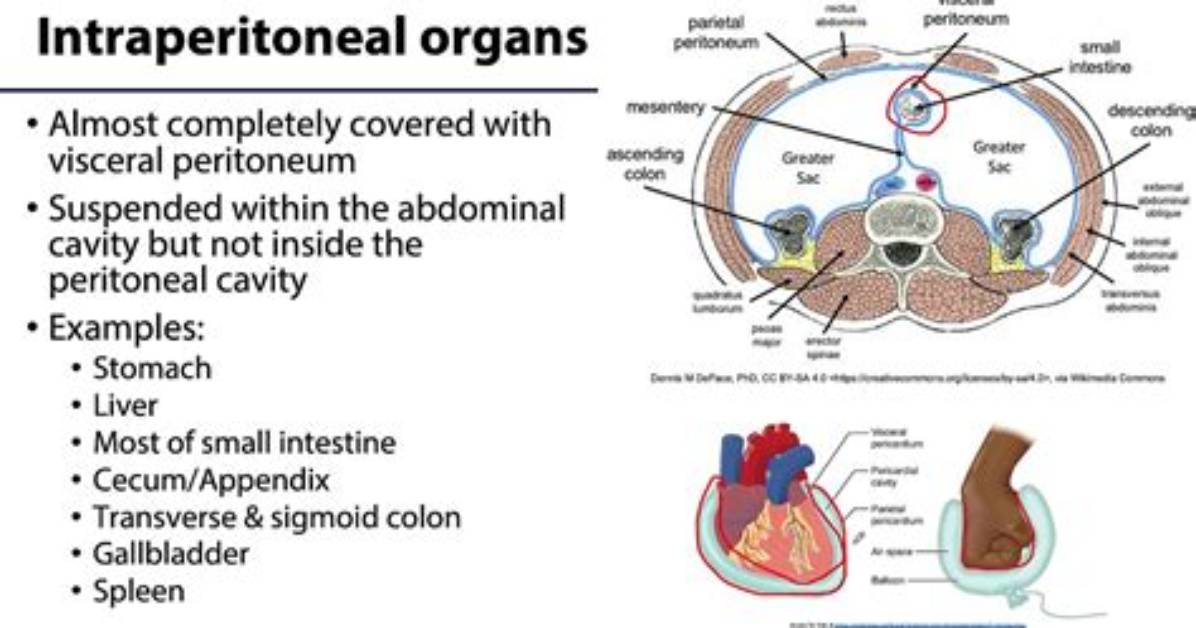What Does Intraperitoneal Mean? | Contextresponse. Com