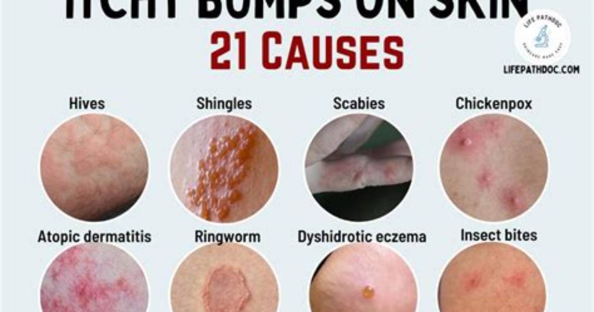 What Does It Mean When You Itch All over?