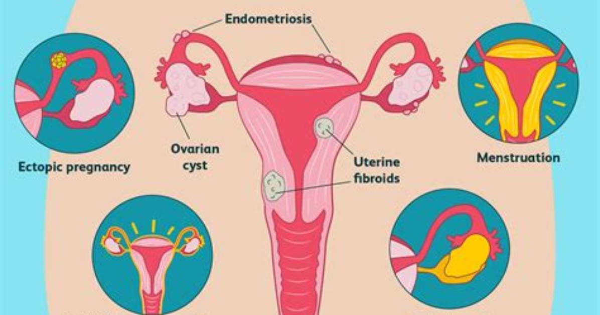 What Does It Mean When Your Ovaries Hurt?