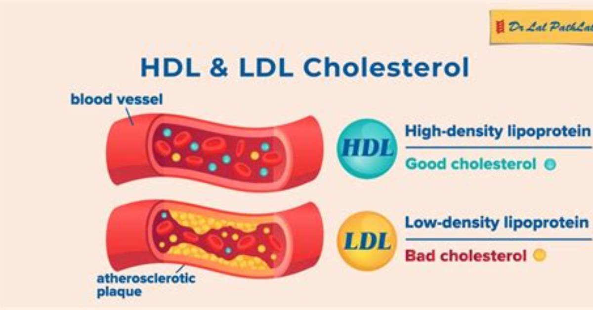 What Does Ldl C Mean?