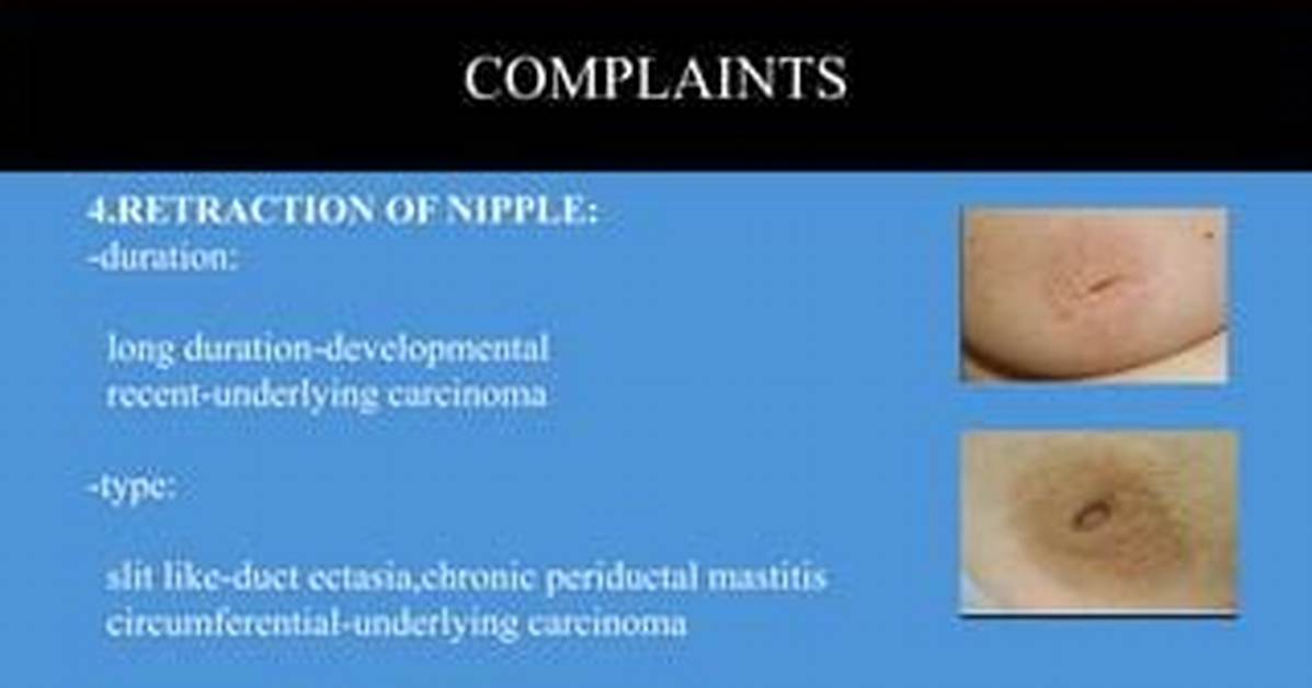 What Does Nipple Retraction Mean