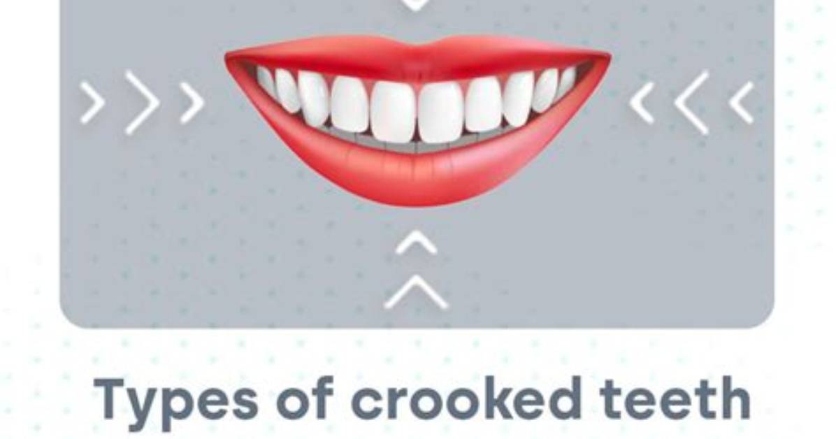 What Does Not Crooked Mean