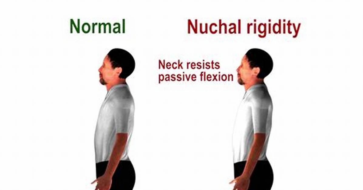 What Does Nuchal Rigidity Feel Like