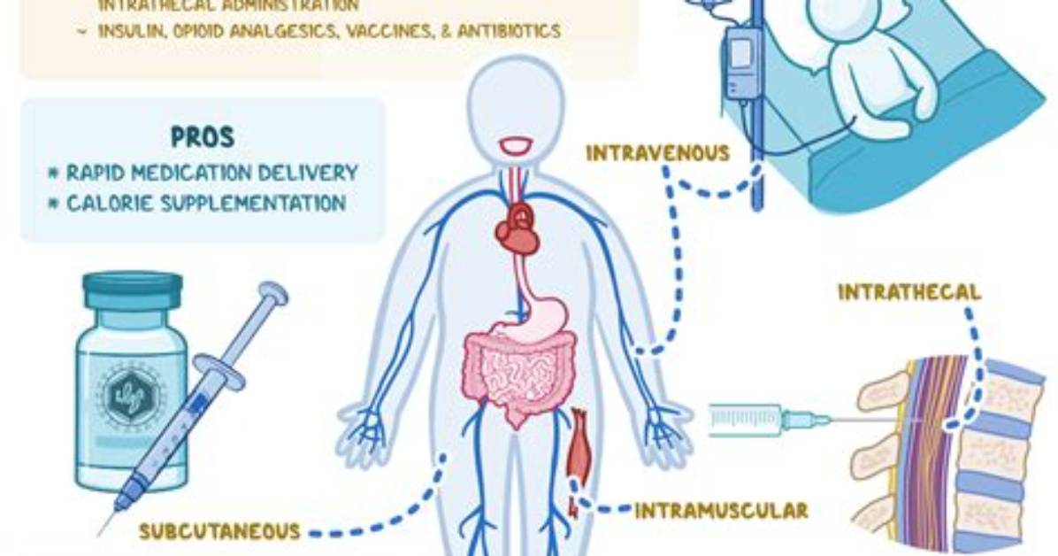 What Does Parenteral Fluids Mean?