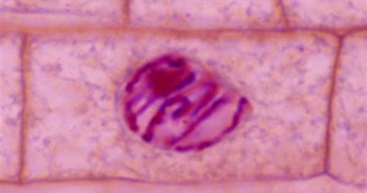 What Does Prophase Look Like Under a Microscope