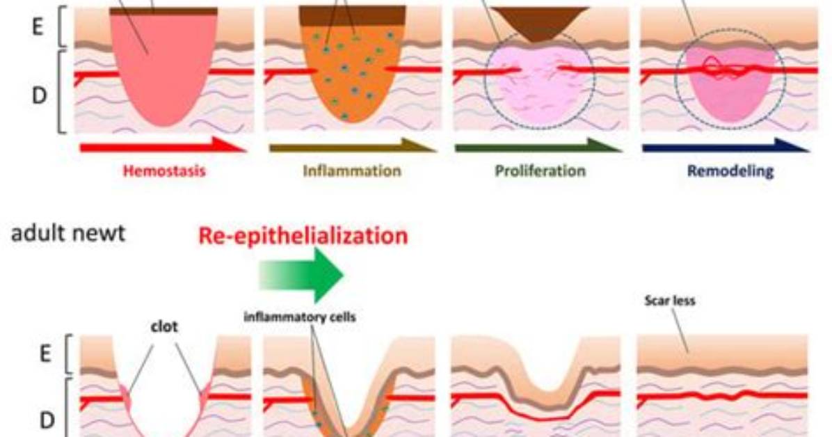 What Does Re Epithelialization Mean?
