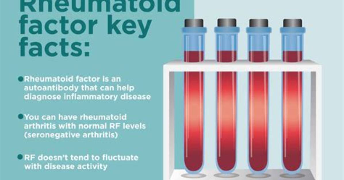 What Does Rheumatoid Factor Mean?