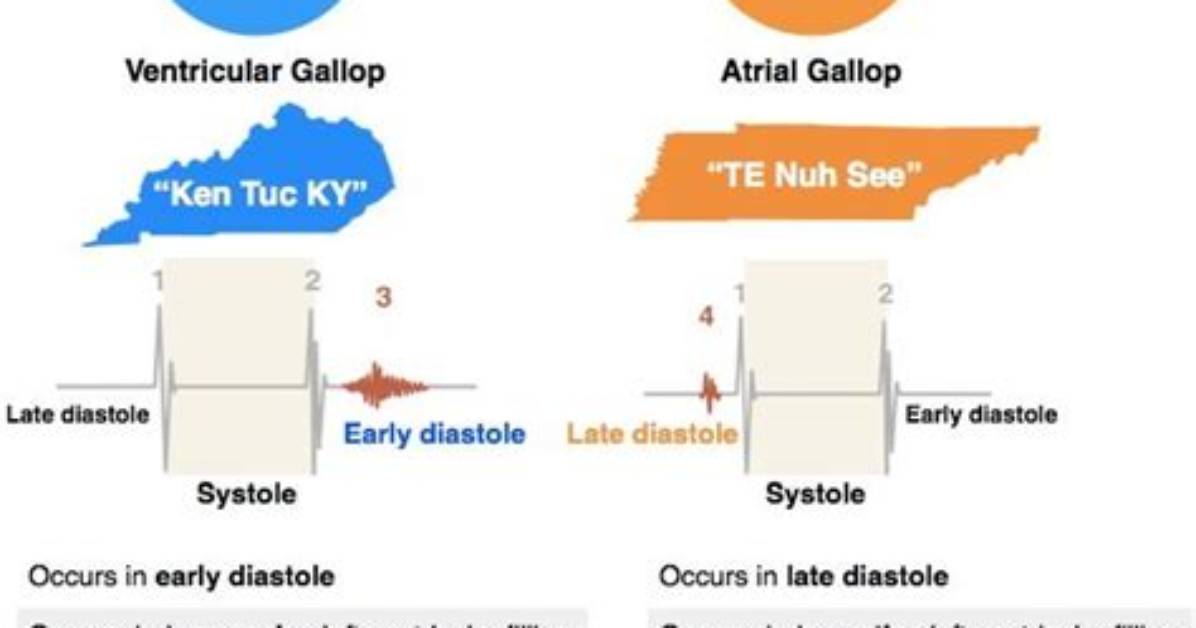 What Does S3 Gallop Mean