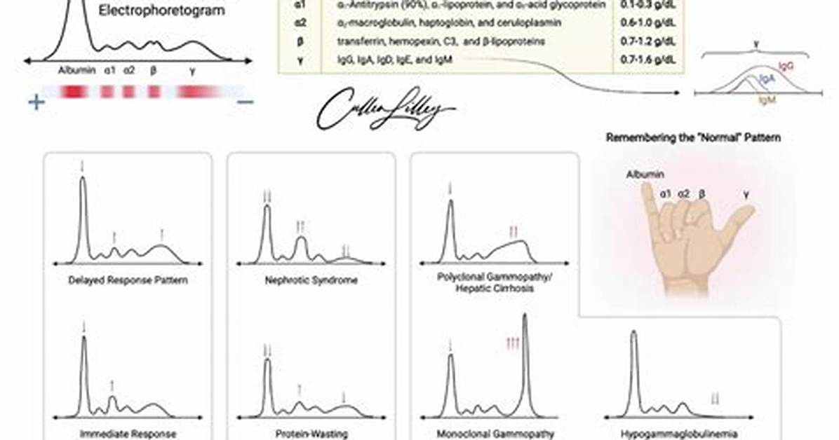 What Does Spep Test For