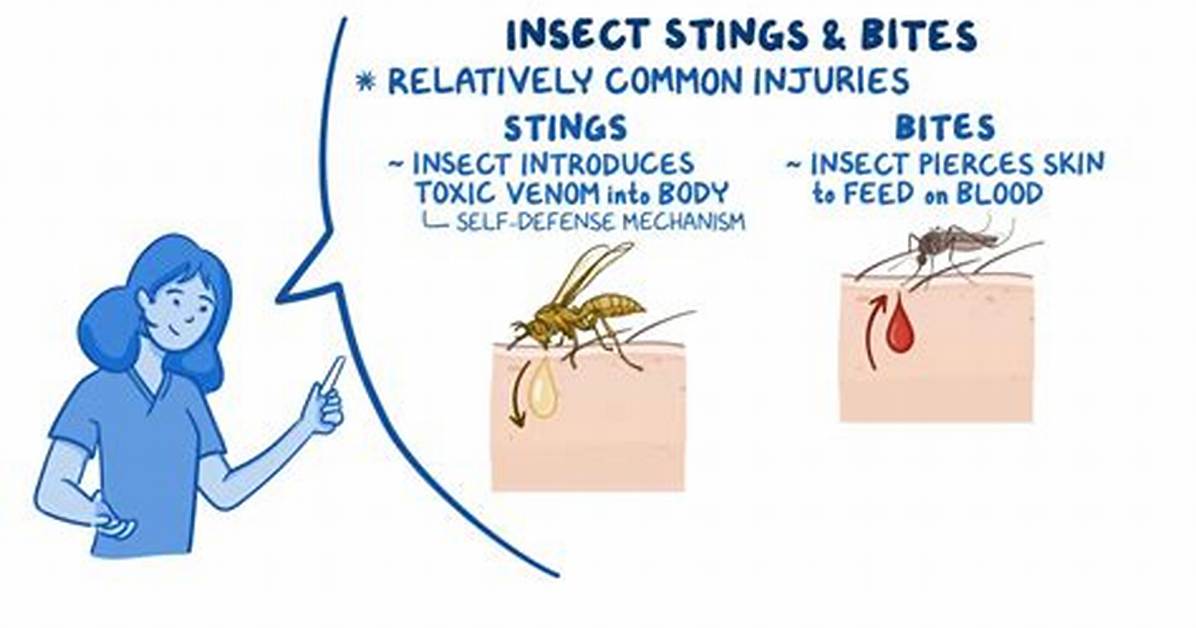 What Does Stinging Mean?