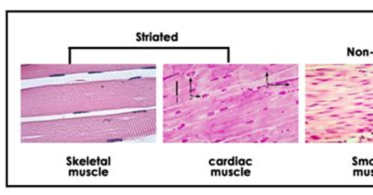What Does Striation Mean?