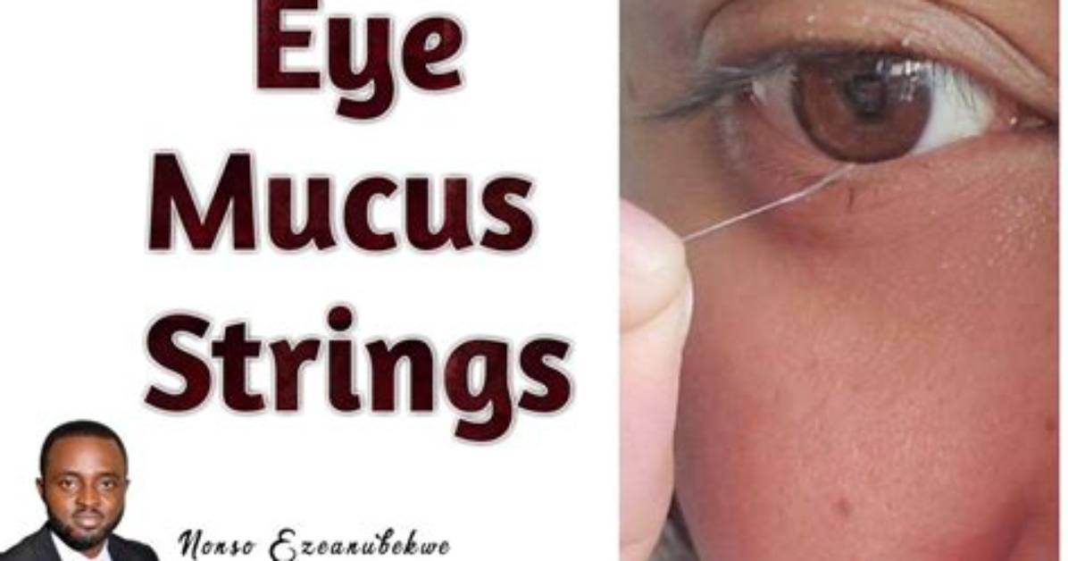 What Does String in Eye Mean?