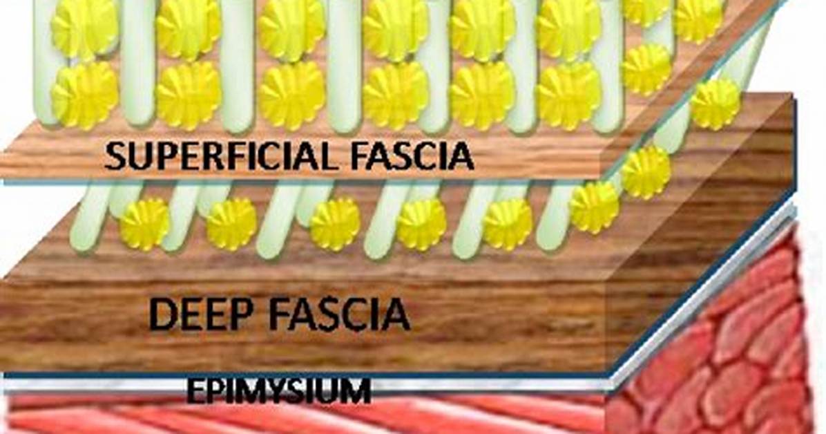 What Does Subfascial Mean?