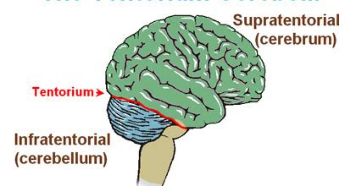 What Does Tentorial Notch Mean?