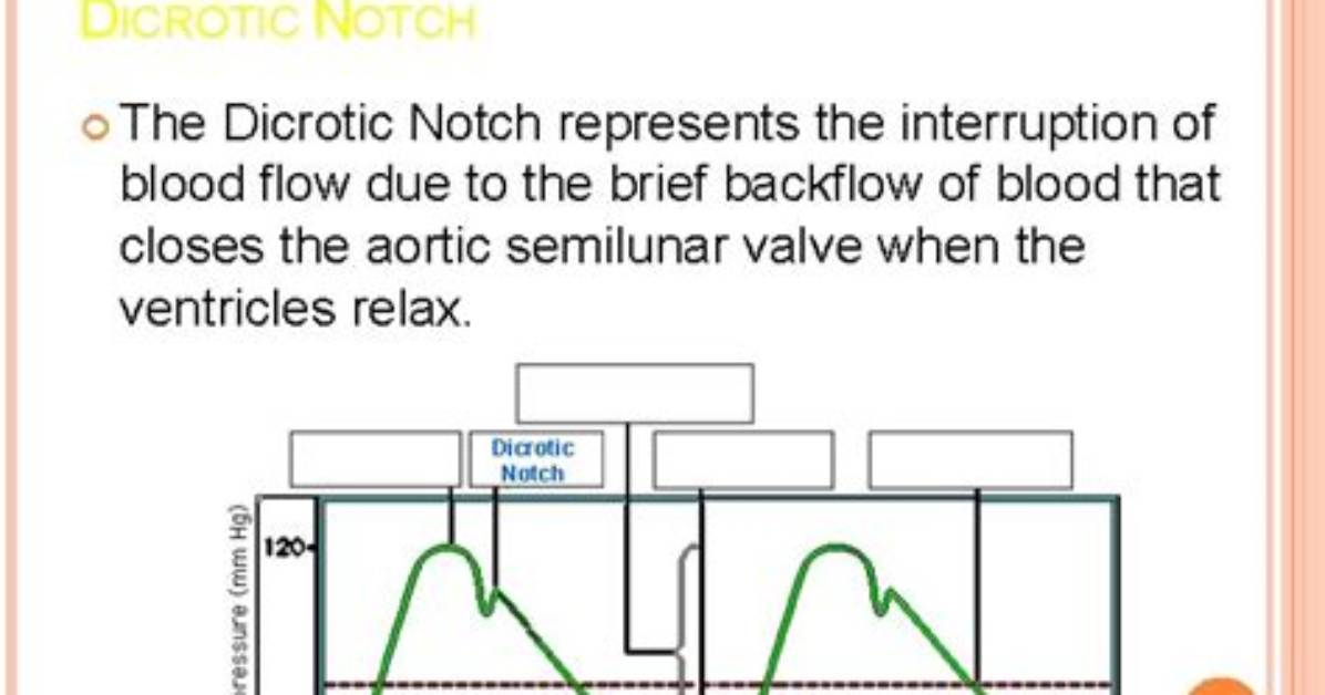 What Does the Dicrotic Notch Represent