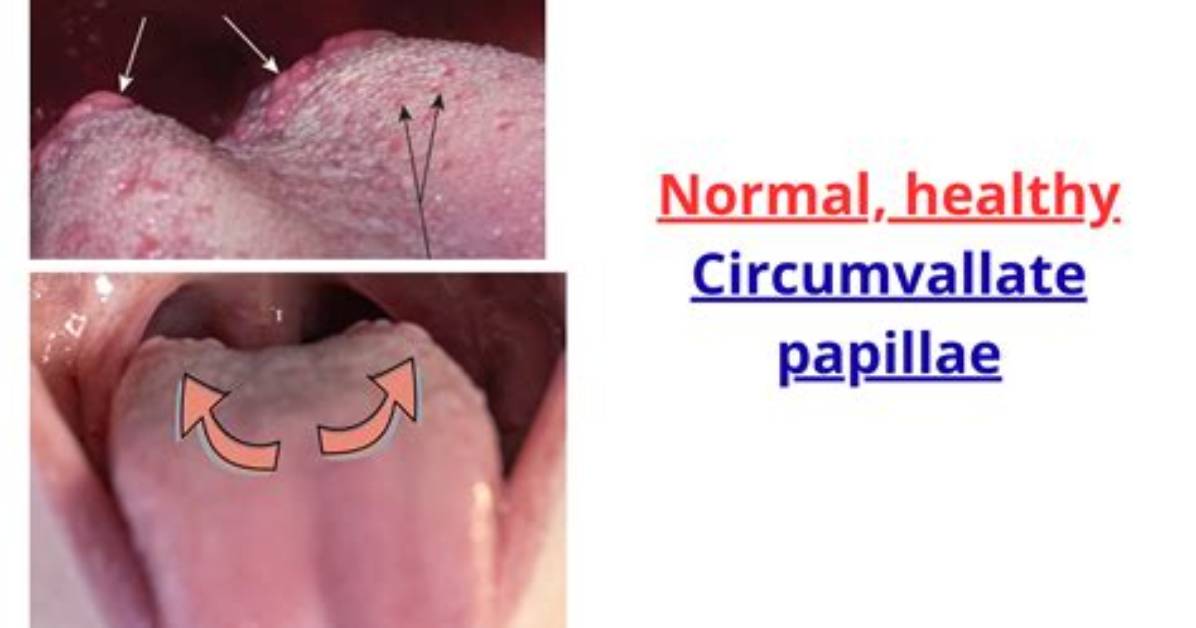 What Does the Papillae Do?