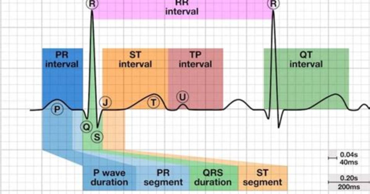 What Does the Pr Interval on an Ecg Reflect?