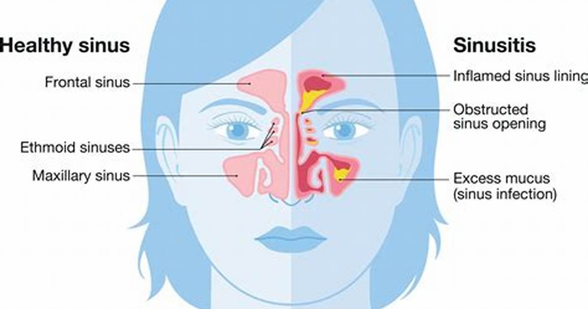 What Does the Sinus Do?