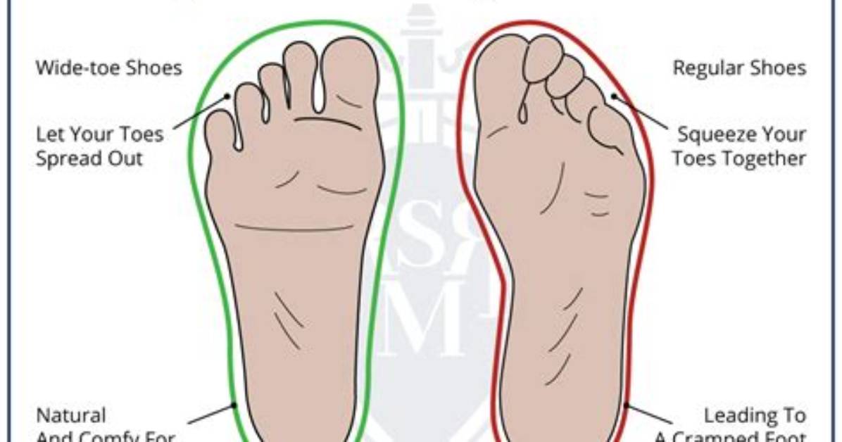 What Does Toe Shoe Mean?