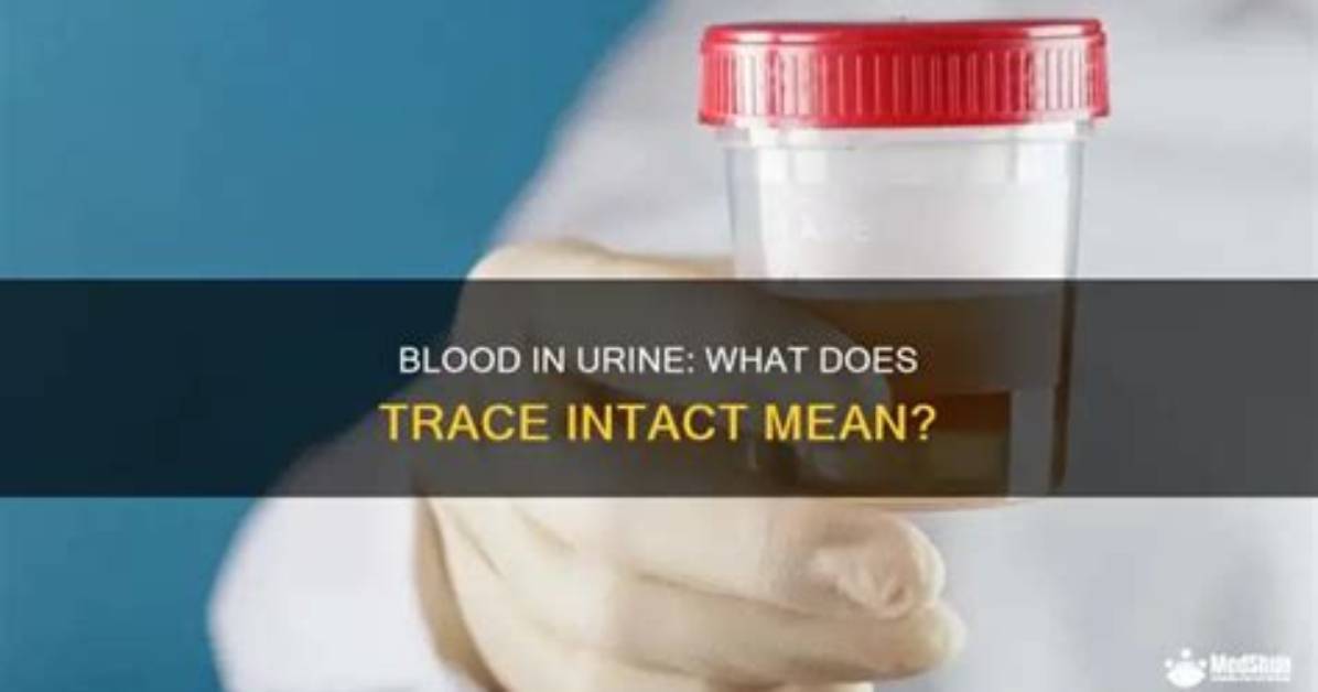 What Does Trace Data Mean