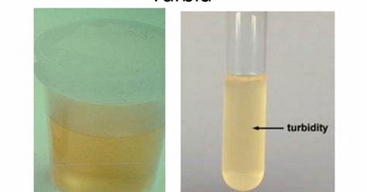 What Does Turbid Urine Indicate