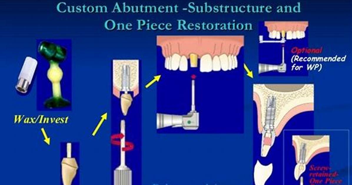 What Does Ucla Abutment Mean