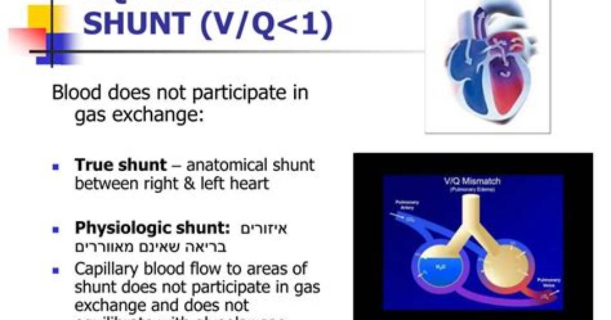 What Does Vq Mismatch Mean
