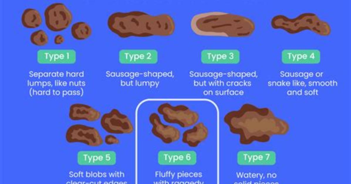 What Frothy Stool Mean?