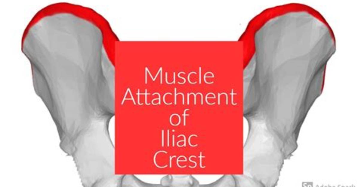 What Inserts on Iliac Crest