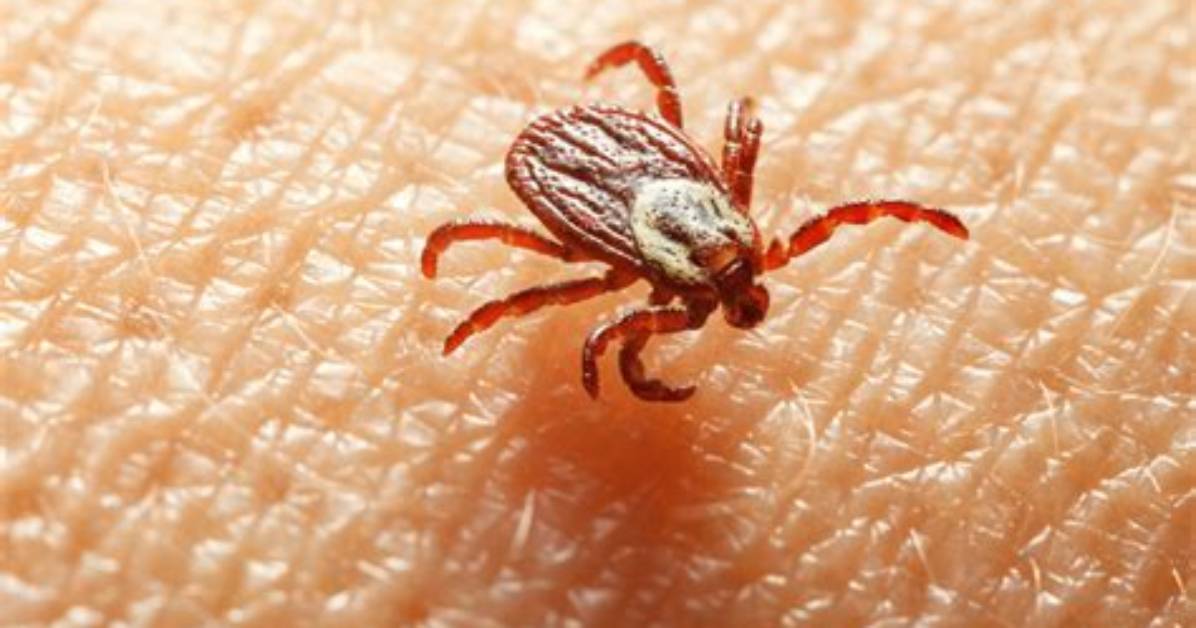 What Instantly Kills Ticks
