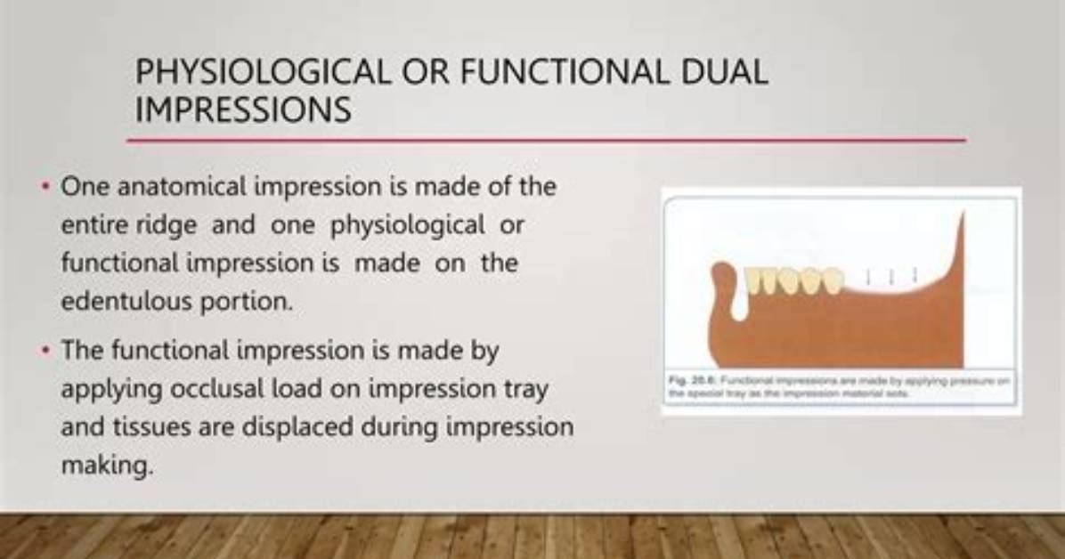 What Is a Functional Impression