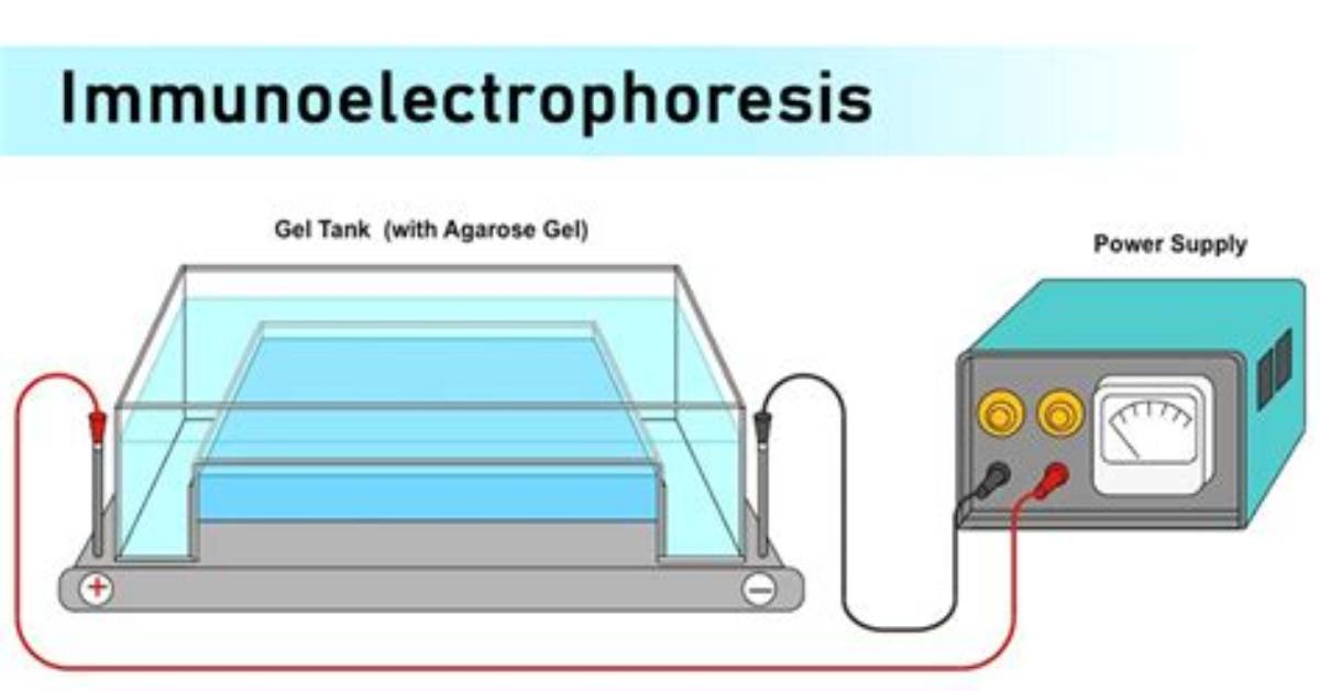 What Is a Immunoelectrophoresis Test