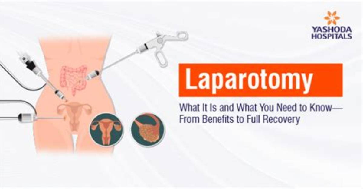 What Is a Laparotomy Surgery