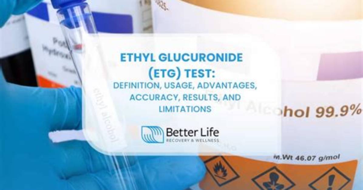 What Is a Normal Ethyl Glucuronide Level?