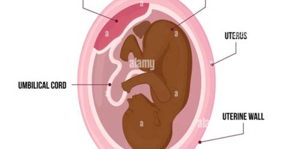What Is a Normal Placenta