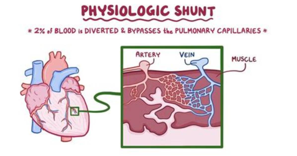 What Is a Physiologic Shunt