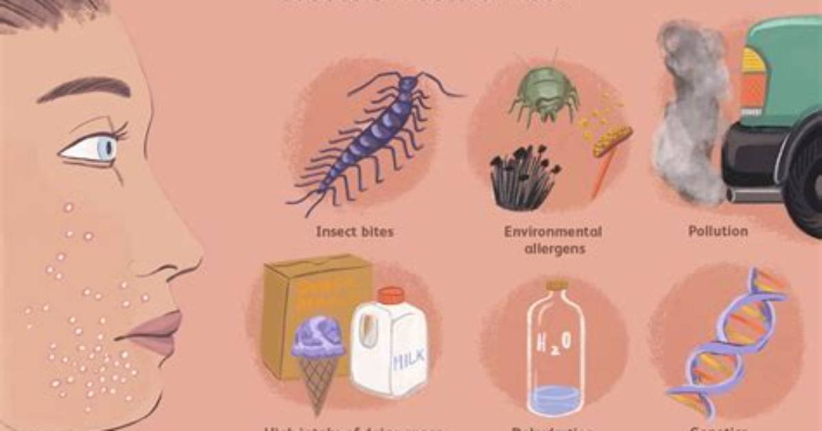 What Is a Pustular Rash?